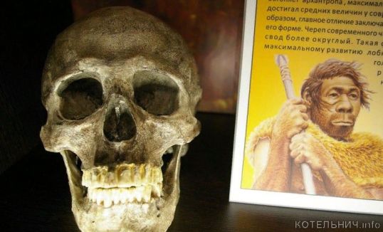 Улыбка «Люси»