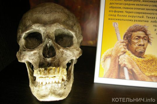 Улыбка «Люси»